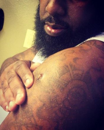 Trae Tha Truth retira bala de braço